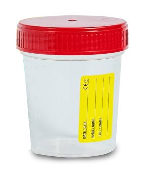 Contenitore Urina Sterile 150 ml con tappo a vite